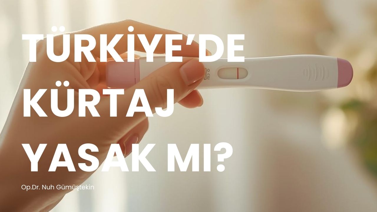 turkiyede-kurtaj-yasak-mi