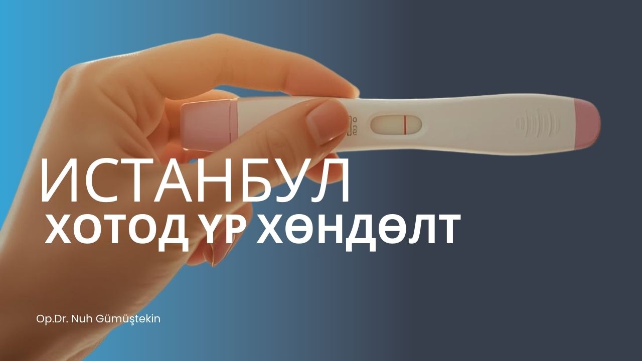 Истанбул хотод үр хөндөлт