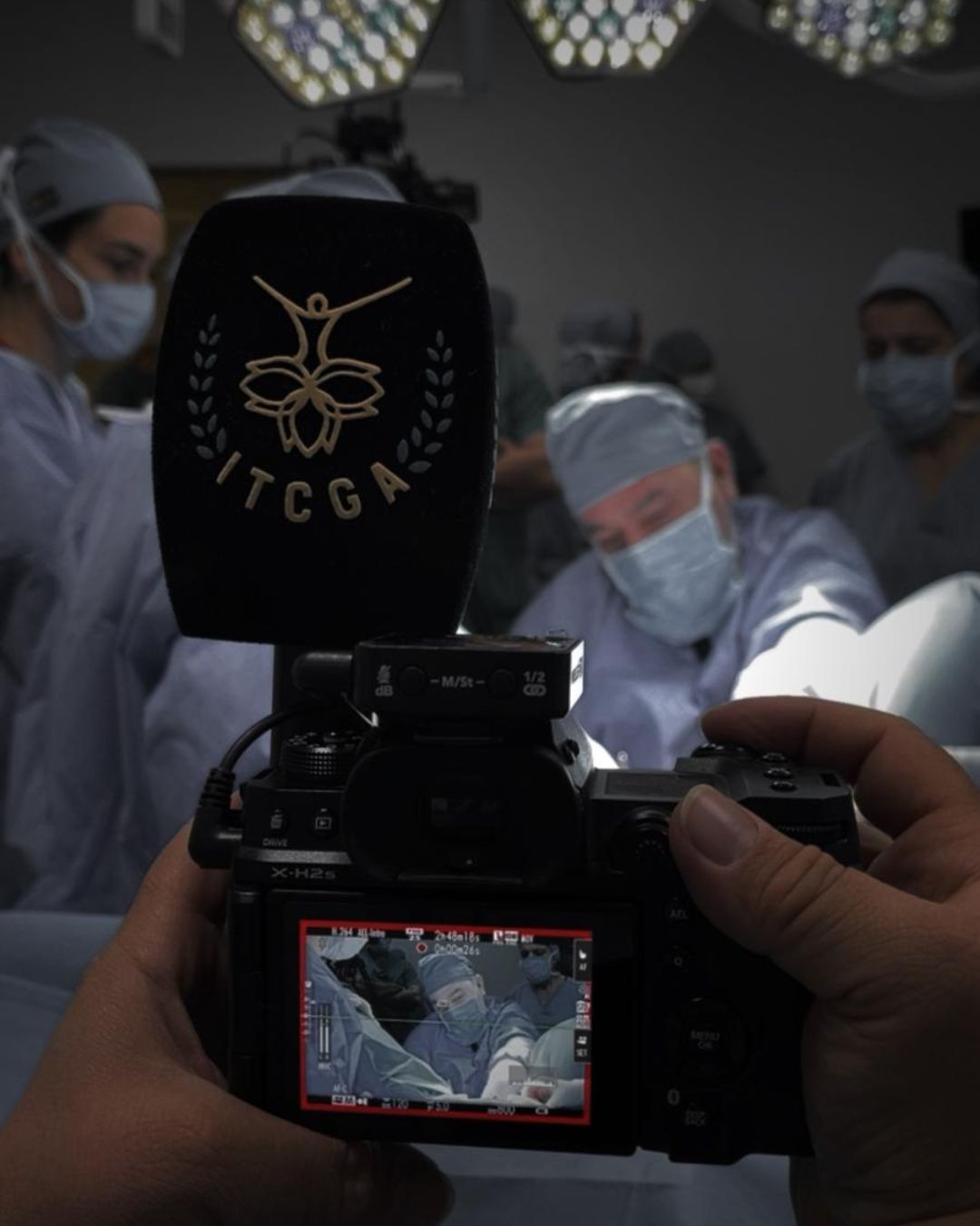 Camera being used to record a surgical procedure in an operating room, with surgeons in scrubs and masks in the background.
